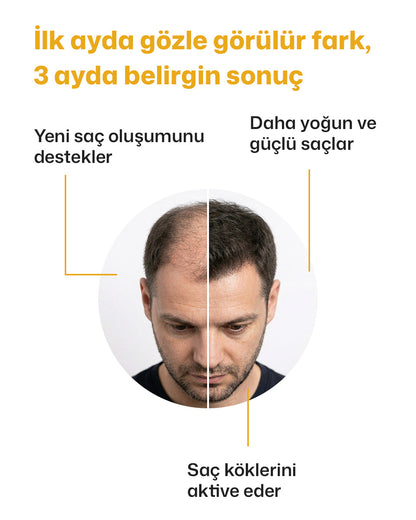 Dr Medi Root Anti-Hair Loss Saç Bakım Seti – Saç Dökülmesine Karşı Kök Destekleyici Şampuan & Sprey